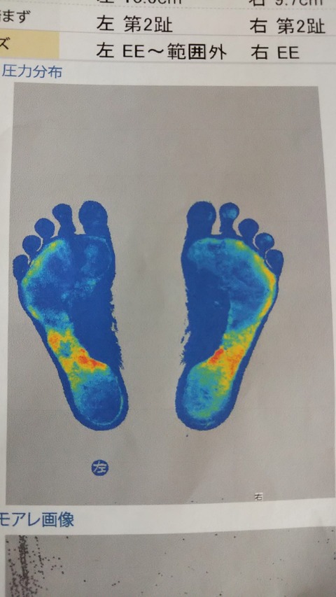 「フットルック(足裏体圧測定)」で分かること。