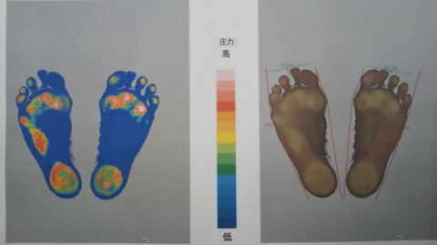 歩くこともままならないお客さまに。