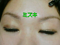 アイテープを使いました 二重になりたい