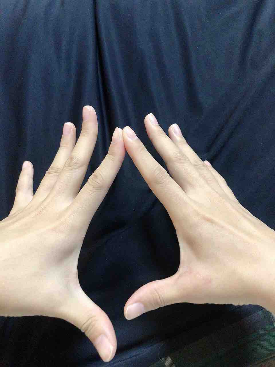 靭帯損傷ログ 手術から3ヶ月目 テラスヒビ 靭帯損傷ログ 手術から3ヶ月目 テラスヒビ