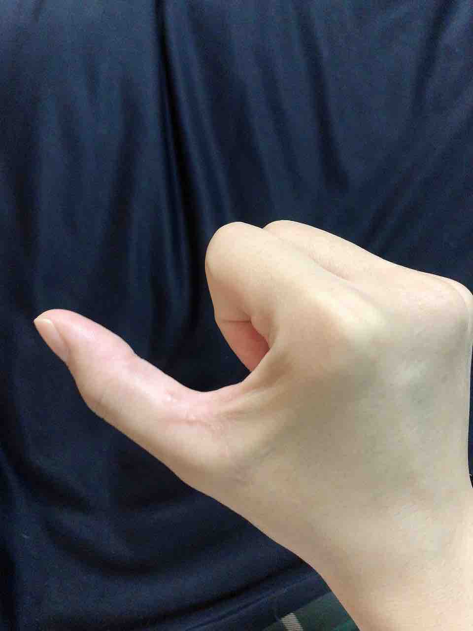 靭帯損傷ログ 手術から3ヶ月目 テラスヒビ 靭帯損傷ログ 手術から3ヶ月目 テラスヒビ