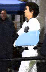 松井骨折