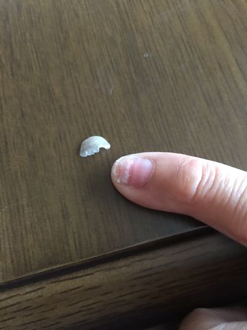 爪が剥がれた T T 乳癌ガンガーンな闘病記