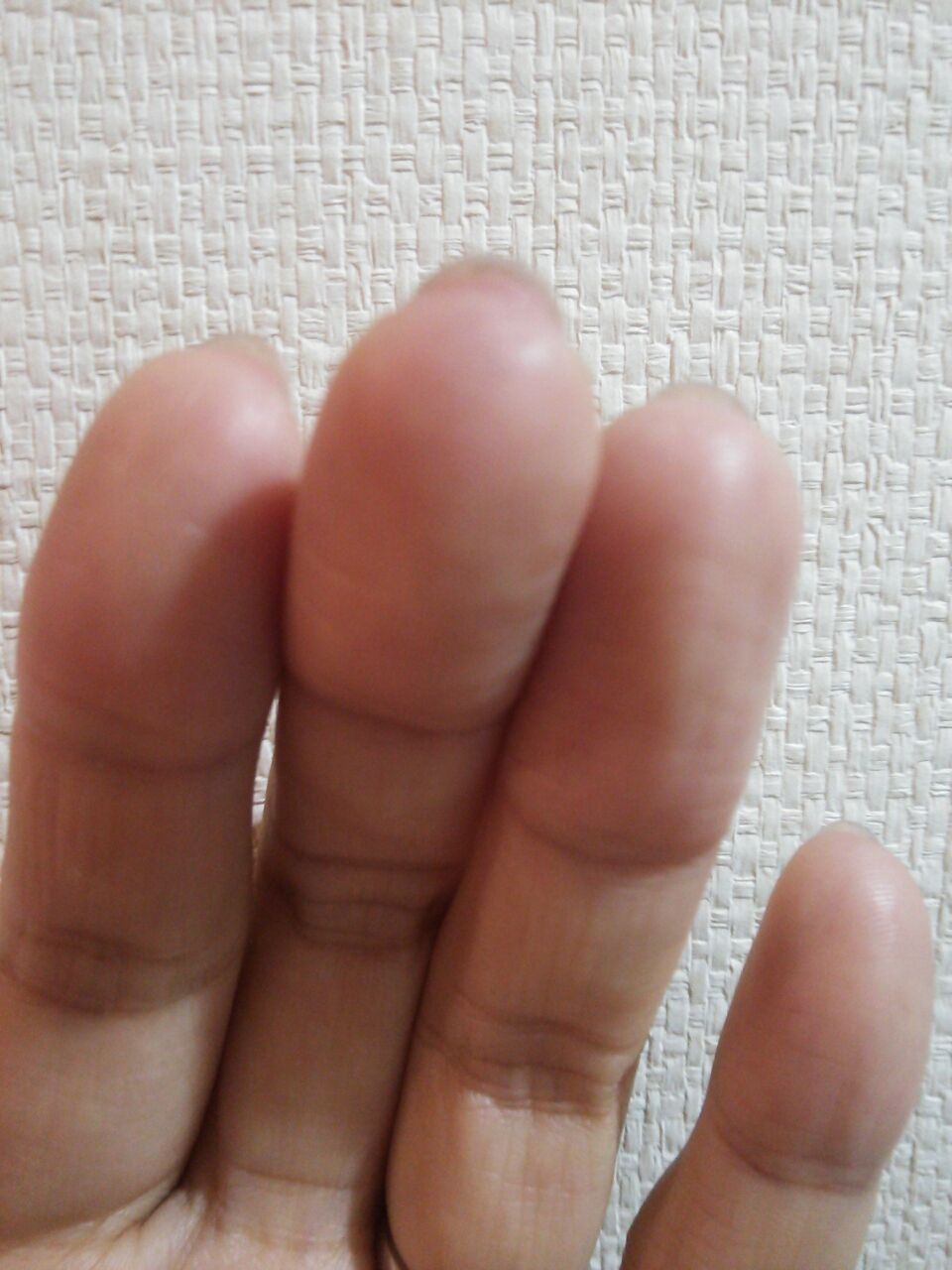爪の裏の皮膚を押し戻す方法 笑 子連れ狼が斬る 人事担当ワーキングマザーの日記 爪の裏の皮膚を押し戻す方法 笑 子連れ狼が斬る 人事担当ワーキングマザーの日記