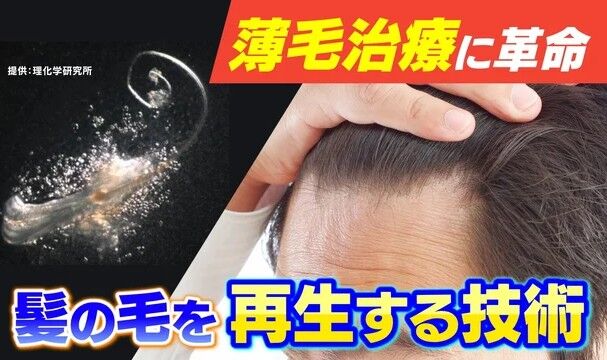 20260502-22621118-tuliptv-000-1-view