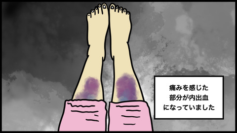 ７３６内出血.010