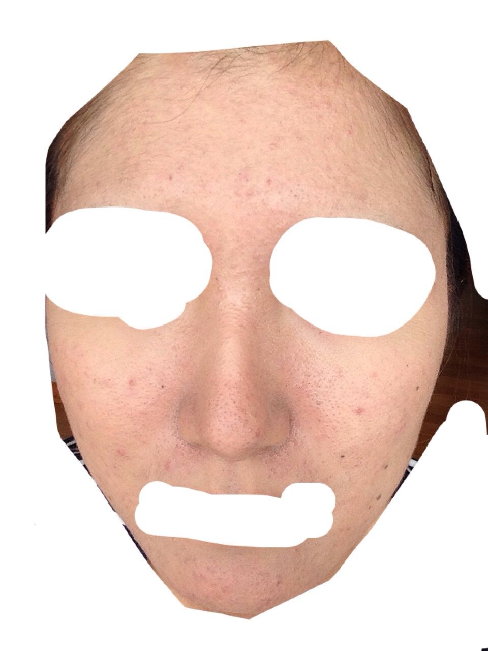 はじめてのクロロフィル美顔教室 クロロ一日目 朝 ミラクル汚肌代olのクロロフィル体験記