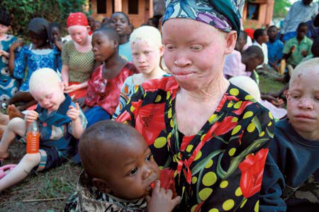 Seize Tha Day Albino Hunting In East Africa Seize Tha Day Albino Hunting In East Africa