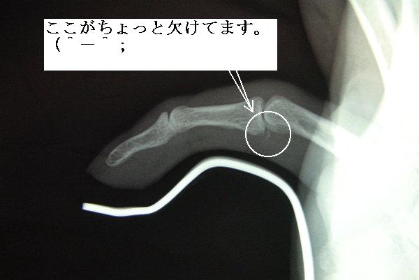 まだ骨もどらず ｋａｎａｍｅの気ままな部屋