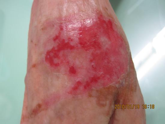 アイドル Fuji 7girls 全員が全身やけどで芸能活動休止へ パチのpv撮影中 僕が気になってること