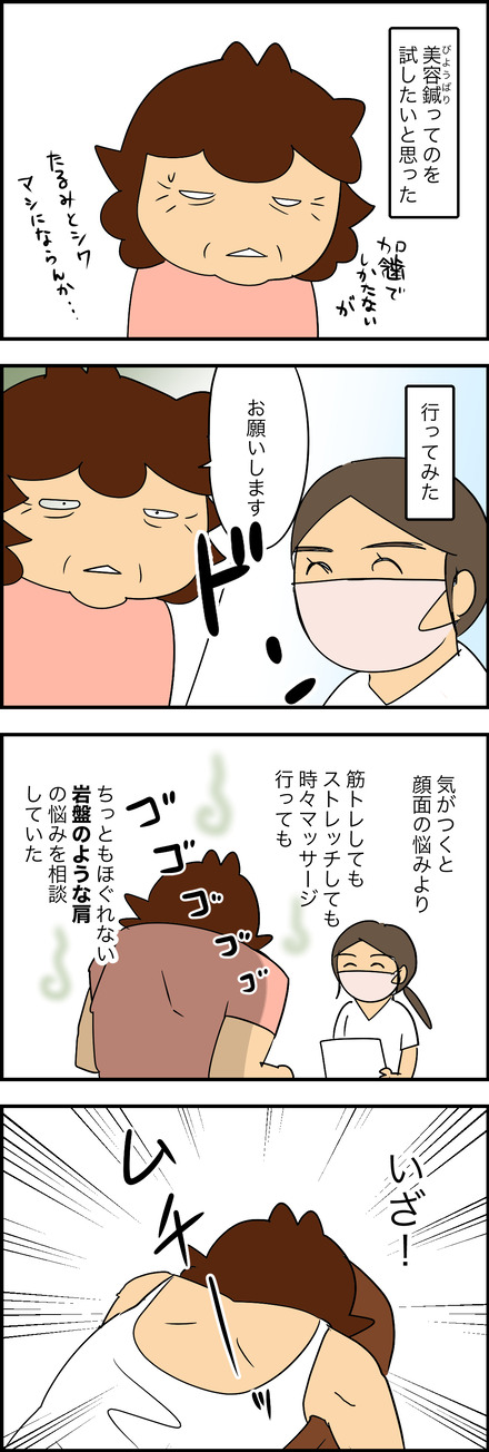 apr112025-1鍼