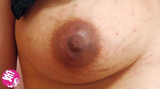 乳首観察