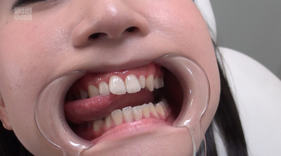 美女の口の中をいやらしく愛撫！ 口腔性感マッサージ！