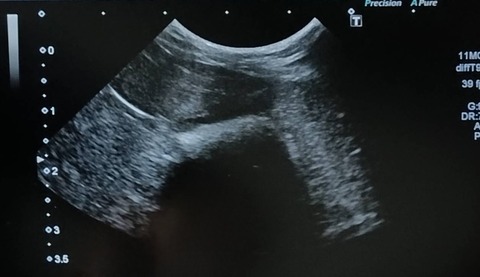 2025-02-03-00-17-58-866