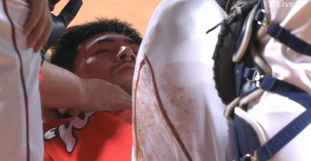 會澤山井頭部死球_05