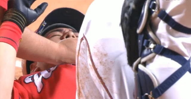 會澤山井頭部死球_04