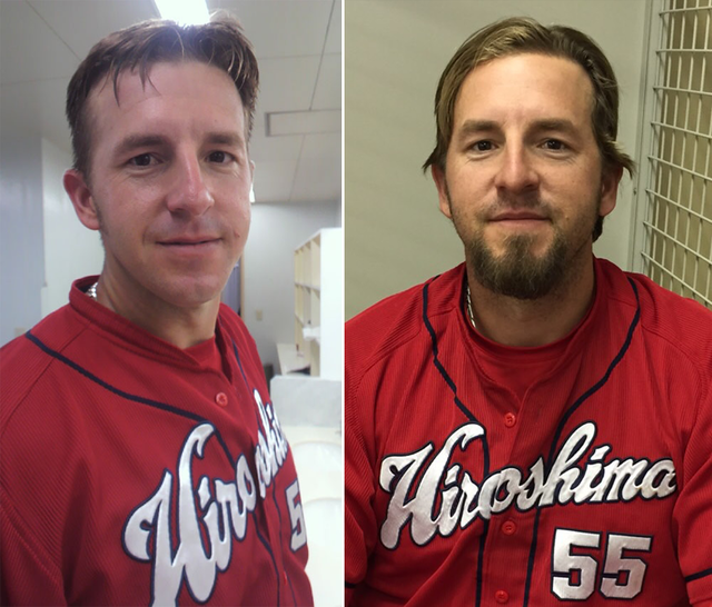 エルドレッド髭比較