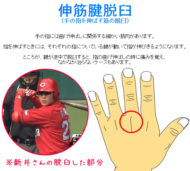 新井脱臼