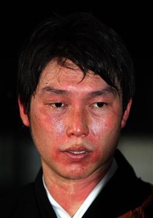 新井さん_護摩行_やけど