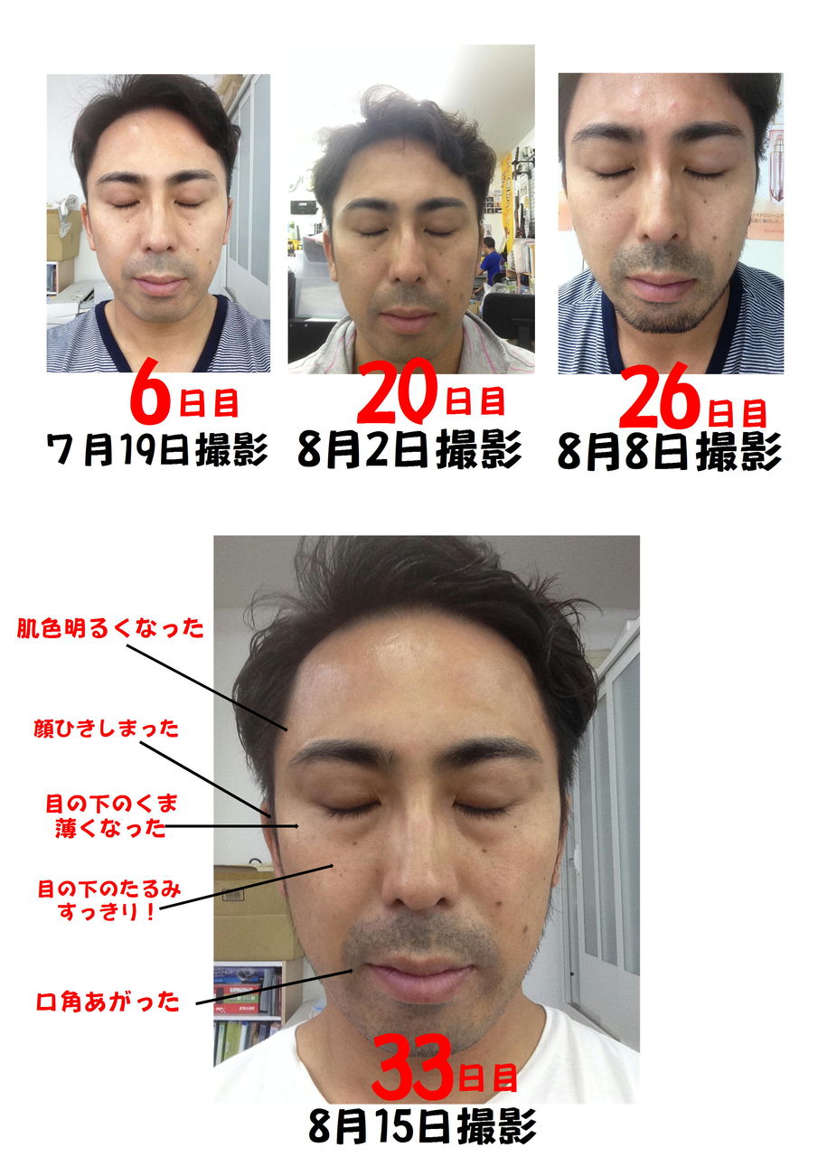 ハイドロジーニアス 33日顔半分で試しました スキンケア メイク講座 化粧品専門店 店長ブログ ハイドロジーニアス 33日顔半分で試しました スキンケア メイク講座 化粧品専門店 店長ブログ