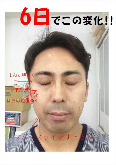 半顔 6日後