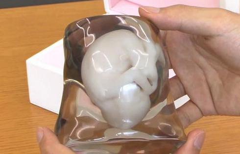 3D model of your unborn baby