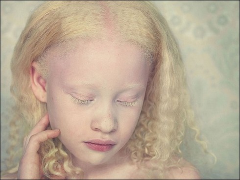 albinos07