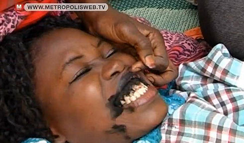 Tattooing of gums in Senegal