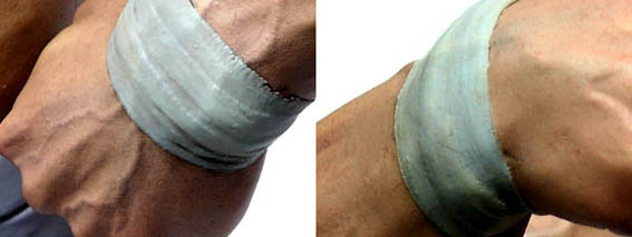 risttape