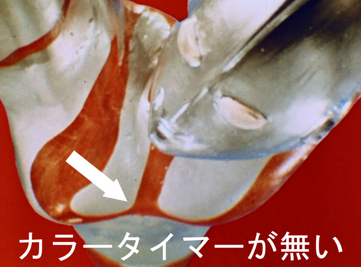 55ǯ�����������饫�顼�����ޡ���̵���ä��� (1)�Υ��ԡ�