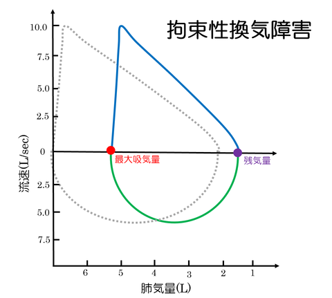 フローボリューム曲線拘束性換気障害