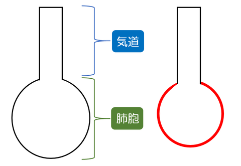 拘束性換気障害