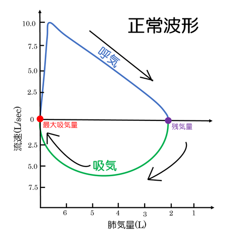 フローボリューム曲線正常波形