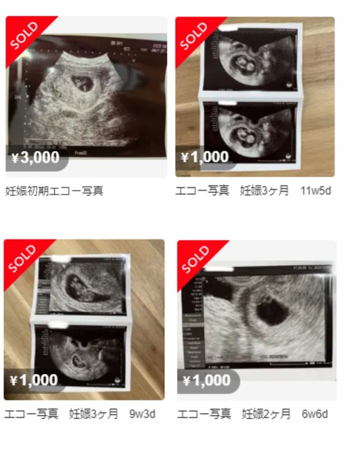 胎児のエコー写真がなぜかフリマサイトに出品され売り切れ続出に