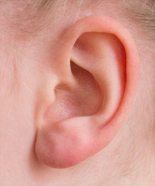 ear-2372090_640_R