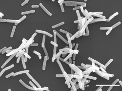 プリン体を無毒化する乳酸菌発見。これで発泡酒がたくさん呑めるな