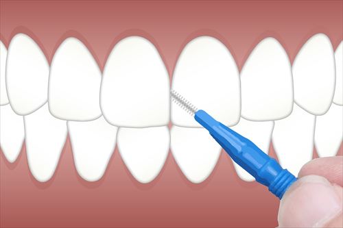 interdental-3597593_1280_R