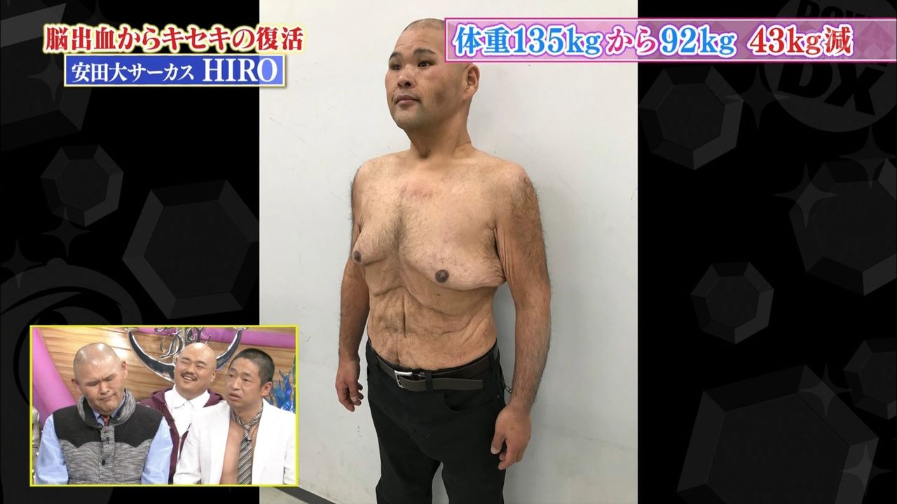 【裸画像あり】 安田大サーカス・HIRO、100kg減量した肉体を公開 ：お料理速報