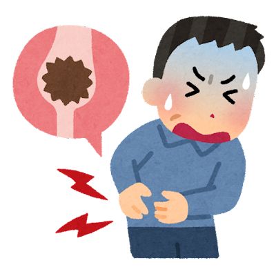 尿路結石痛すぎるｗｗｗｗｗｗｗｗｗｗｗｗ