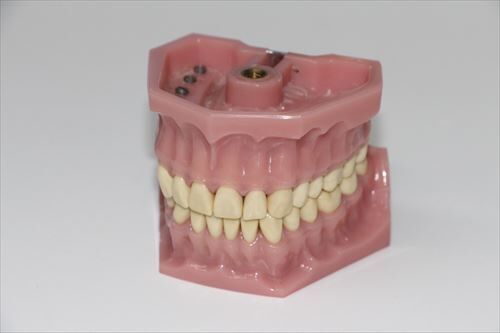 dentures-1514697_1280_R