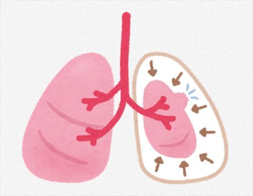 SnapCrab_NoName_2019-7-13_22-14-8_No-00_R