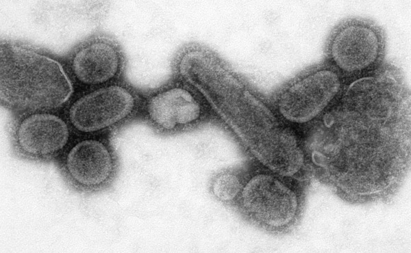 1920px-Reconstructed_Spanish_Flu_Virus