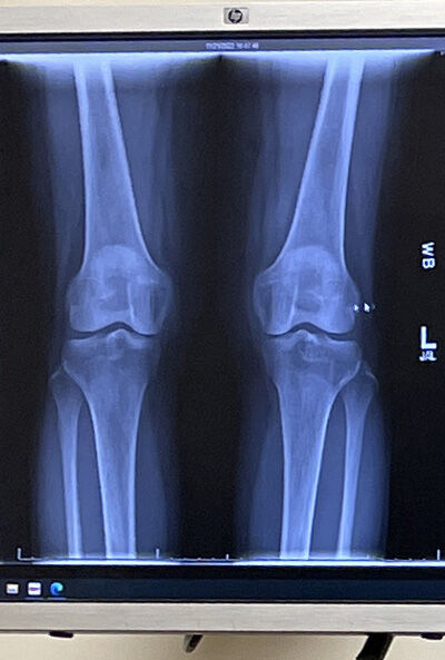 2022-12-15-knee1