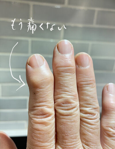 2023-02-23-finger2