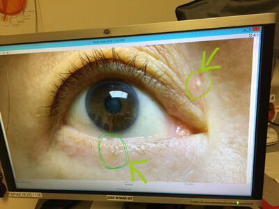 2021-09-10-eye1