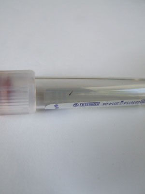 2013-07-03-needle1