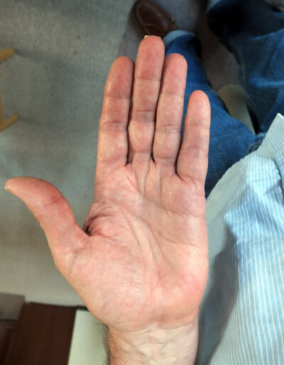 2025-06-10-hand1