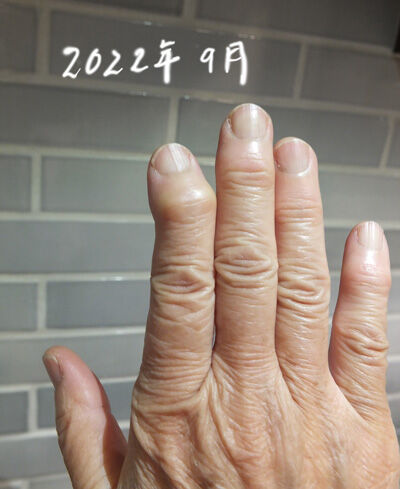 2022-09-11-finger4