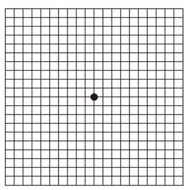 2024-12-04-macular1