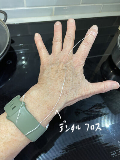 2023-03-25-splint3